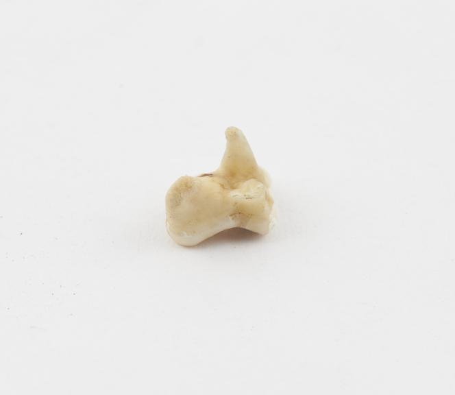 Gazelle's tooth amulet, cure for pain in the side, from Sudan