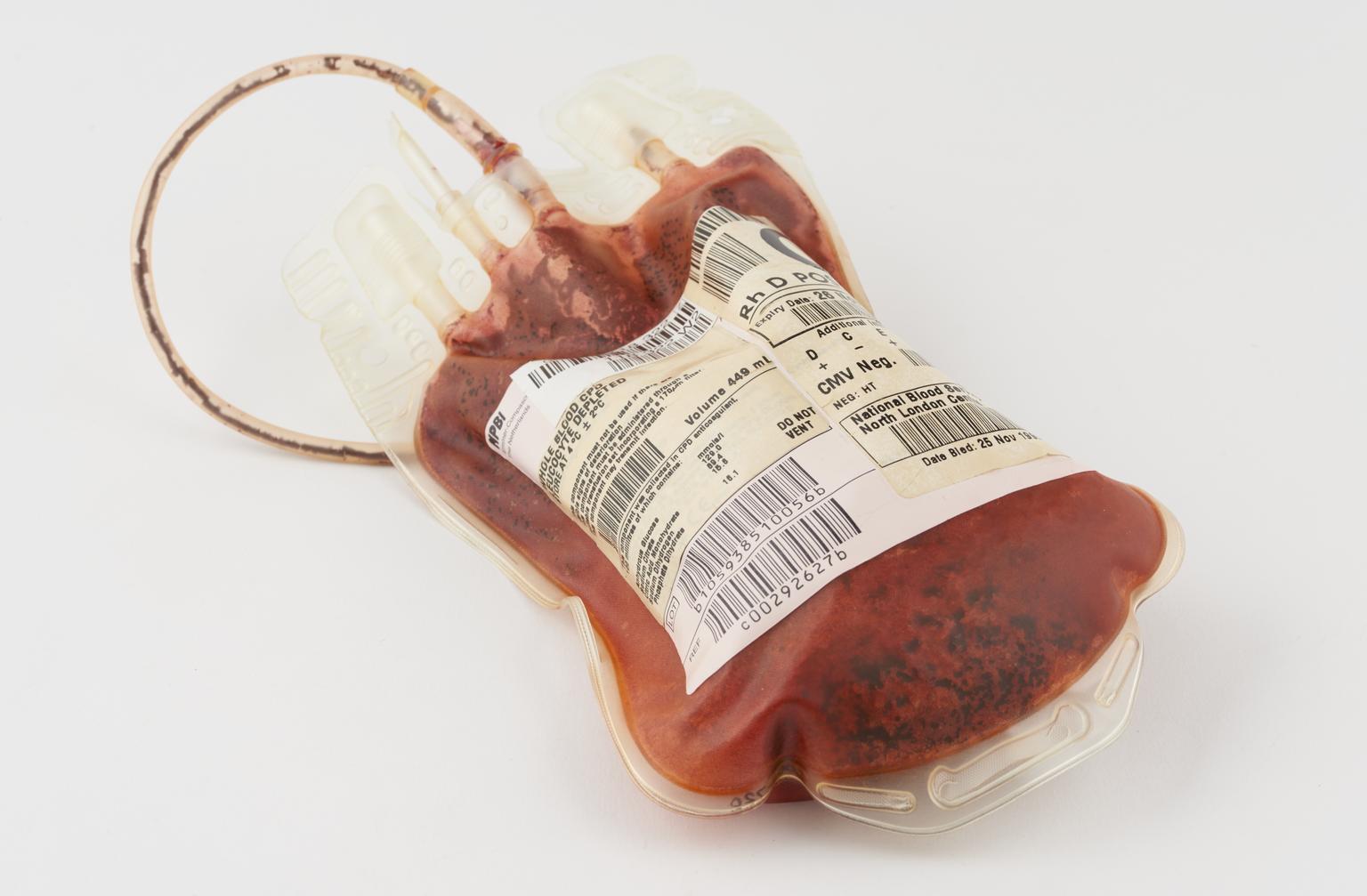 Blood plasma bag, labelled 'O', containing theatrical blood | Science ...