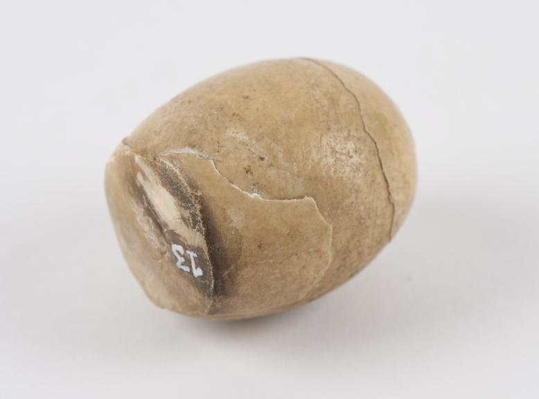 Brushite bezoar, beige coloured, ovoid