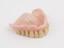 Acrylic upper denture reinforced with orientated polythene