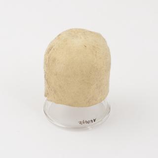 Cupping glass for use with scarificator