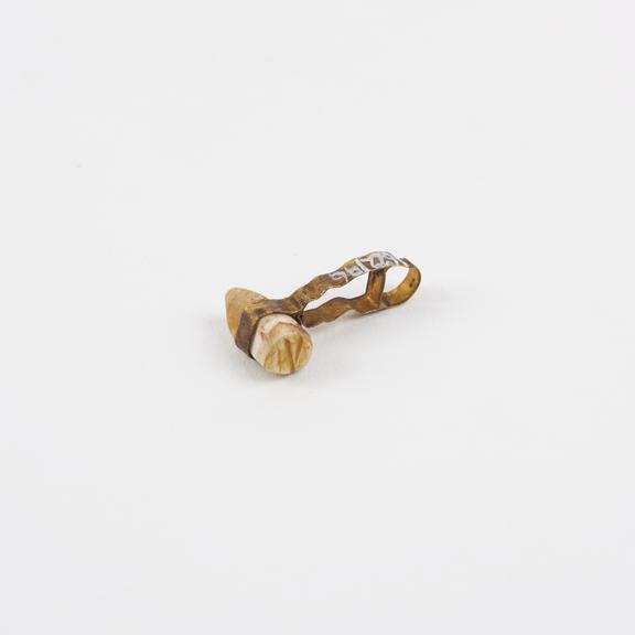 Etruscan denture, copy, to prevent convergence