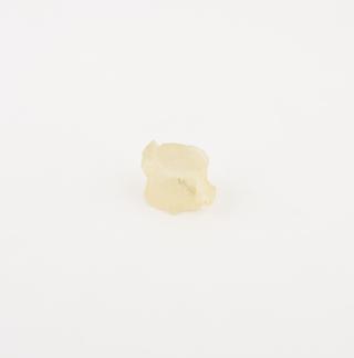 3D printed model of adult kidney