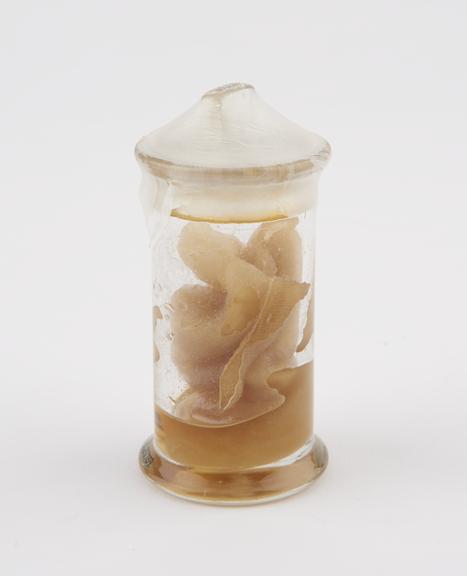 Glass specimen jar, containing gauze which is possibly soaked
