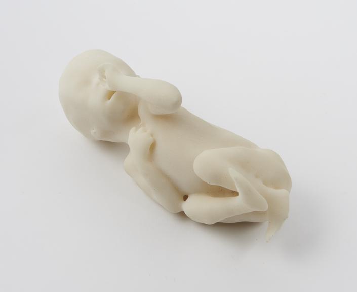 3D printed model of a normal fetus at 22 weeks of gestation