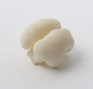 3D printed model of a fetal brain showing agenesis of the corpus callosum at 21 weeks gestation