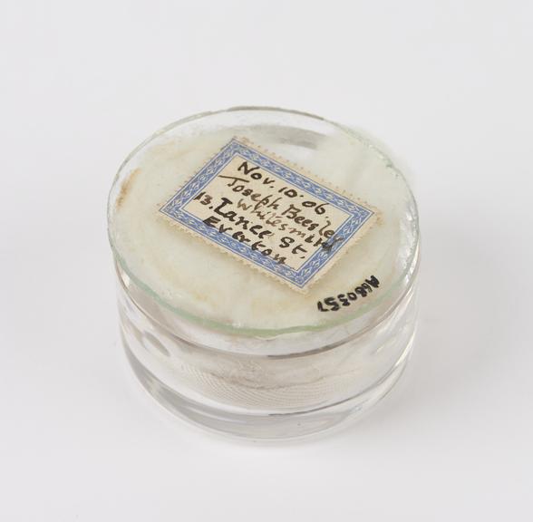 Glass specimen jar, originally containing foreign body removed