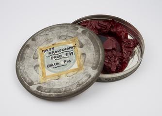 Watson-Odelca apparatus for Mass Radiography