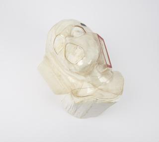 Face mould for administering radiotherapy