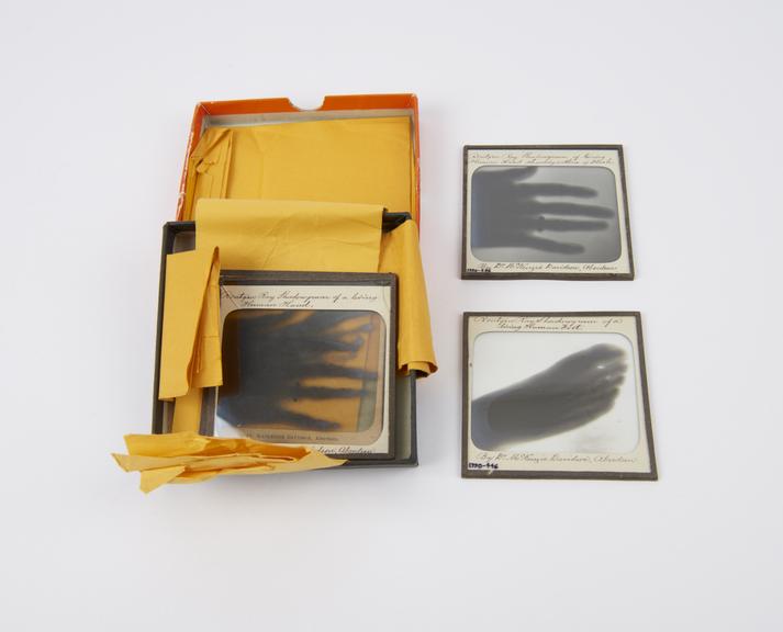Collection of 3 1/4 glass slides of radiographs made by Sir