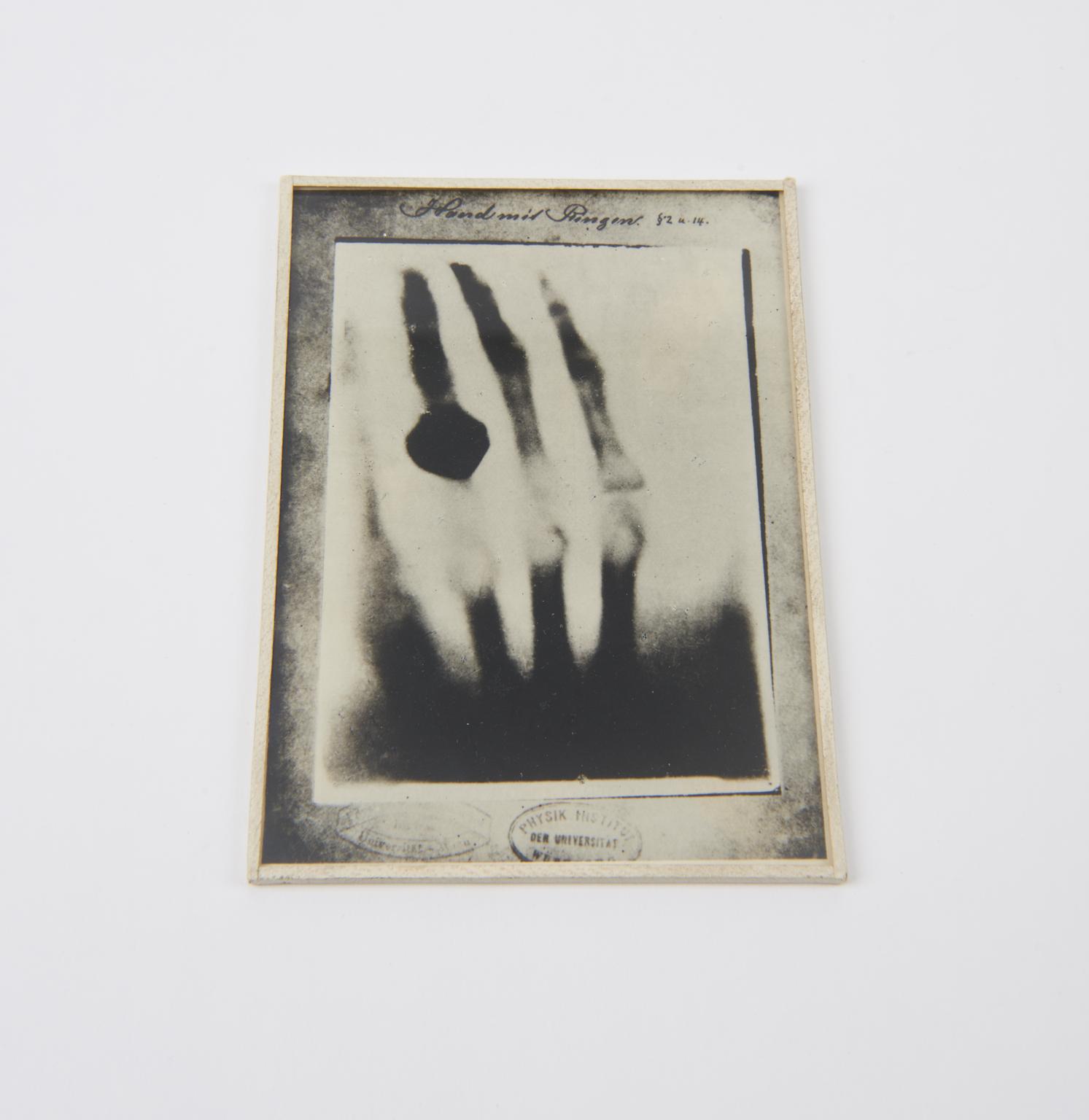 First Radiographers Hand Photograph of a radiograph of hand taken by Wilhelm Conrad Röntgen ...