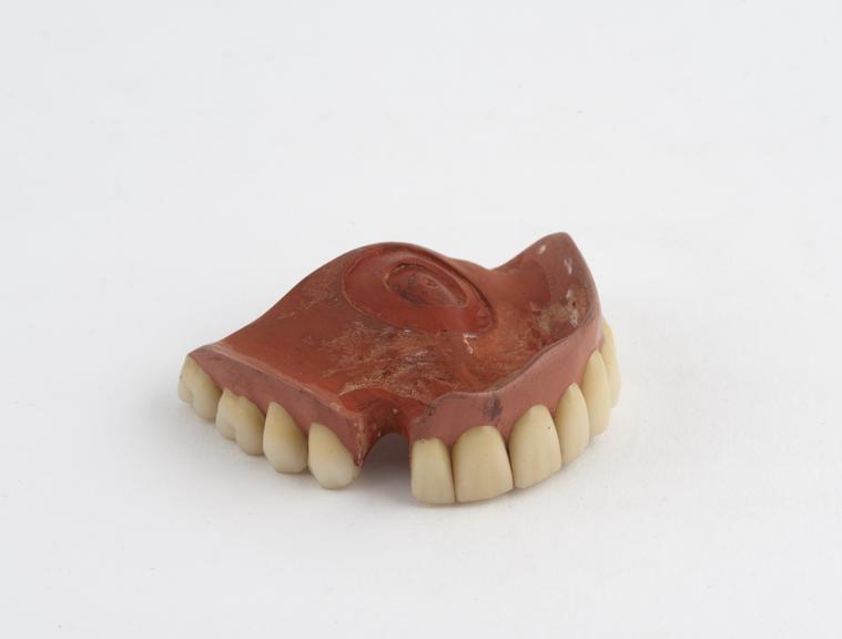 Partical upper denture, vulcanite with porcelain teeth