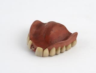 denture