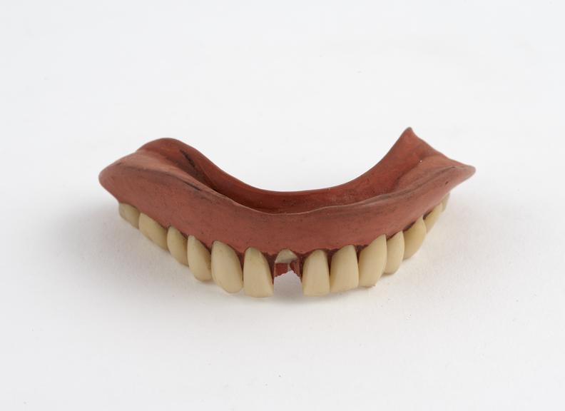 Full lower denture, vulcanite with porcelain teeth, English