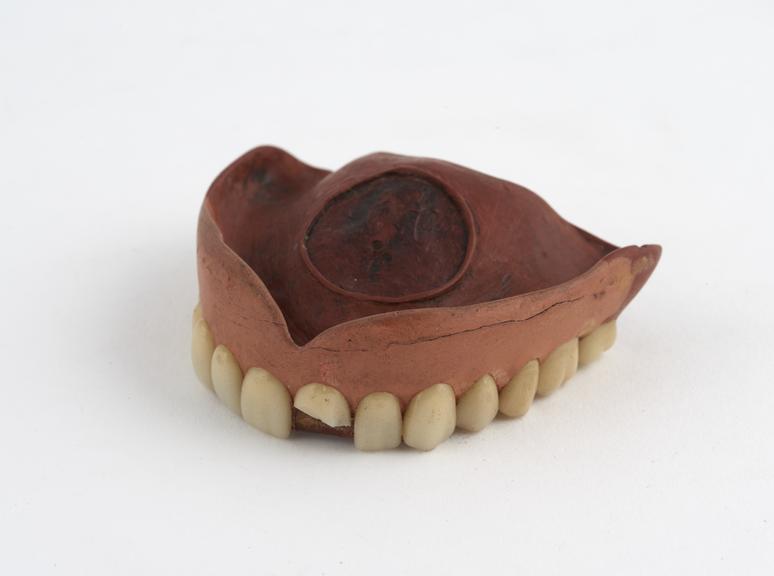 Full upper denture, vulcanite plate with porcelain teeth