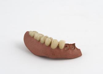 denture