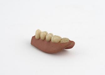 denture