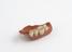 denture