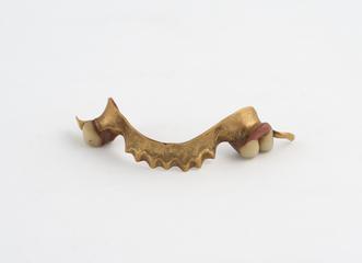 denture