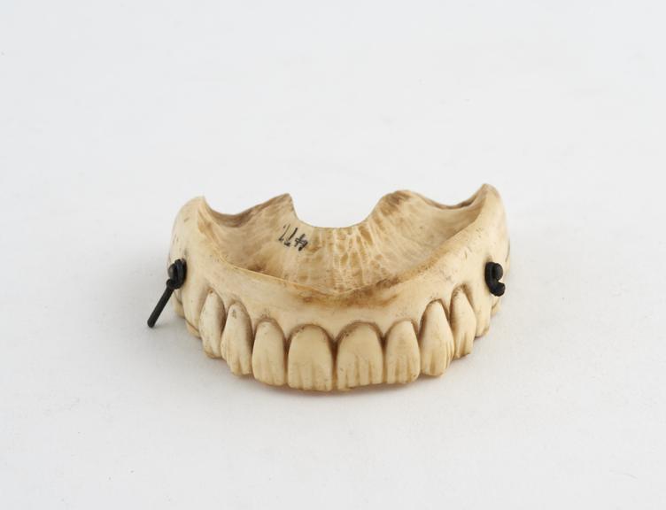 Full upper denture, ivory, English, 1820-1870