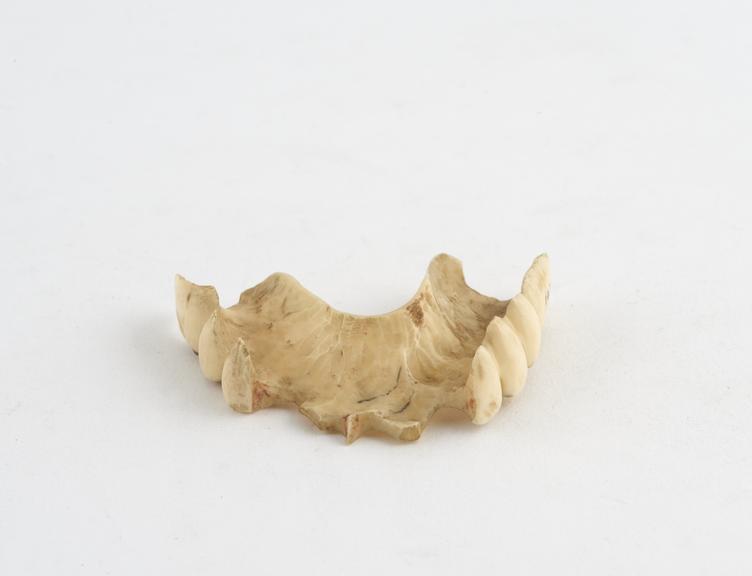 Partial upper denture, ivory, probably English, 1820-1860