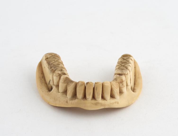 Full lower denture, ivory, English, 1830-1880