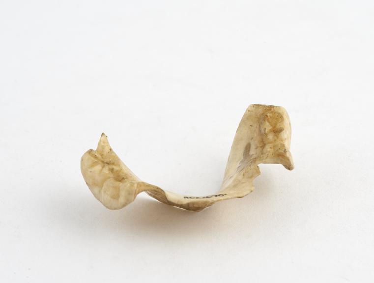 Partial upper denture, ivory, probably English, 1820-1870