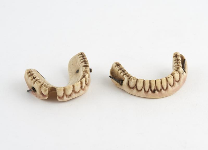 Denture set, full lower and partial upper, ivory