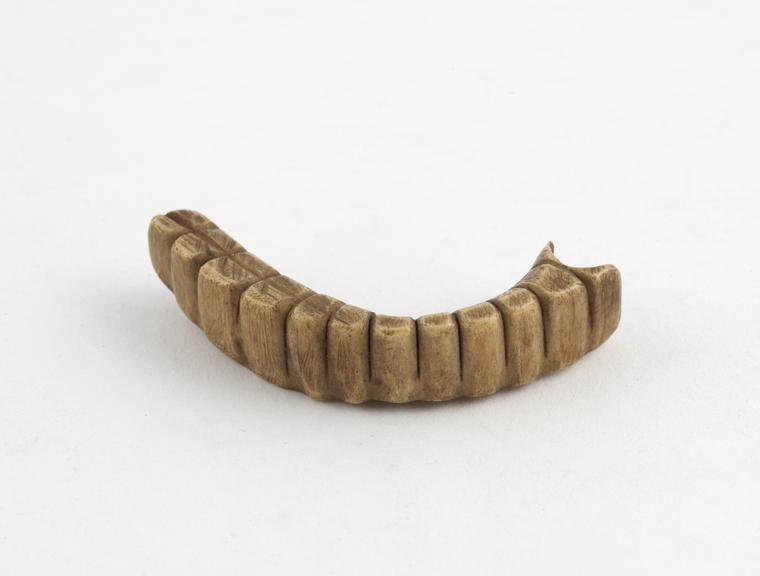 denture
