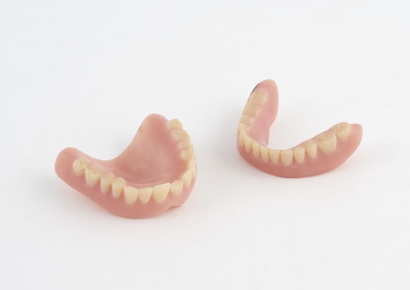 Full denture set, acrylic, English, 1955-1975