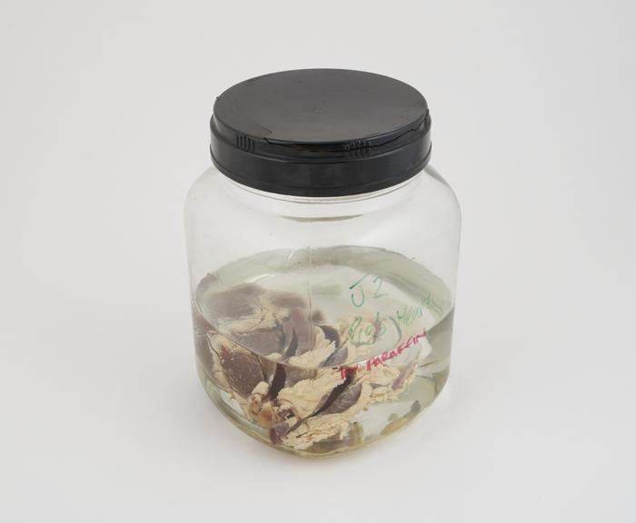 Pig heart in liquid paraffin, in large jar, dated 29.06