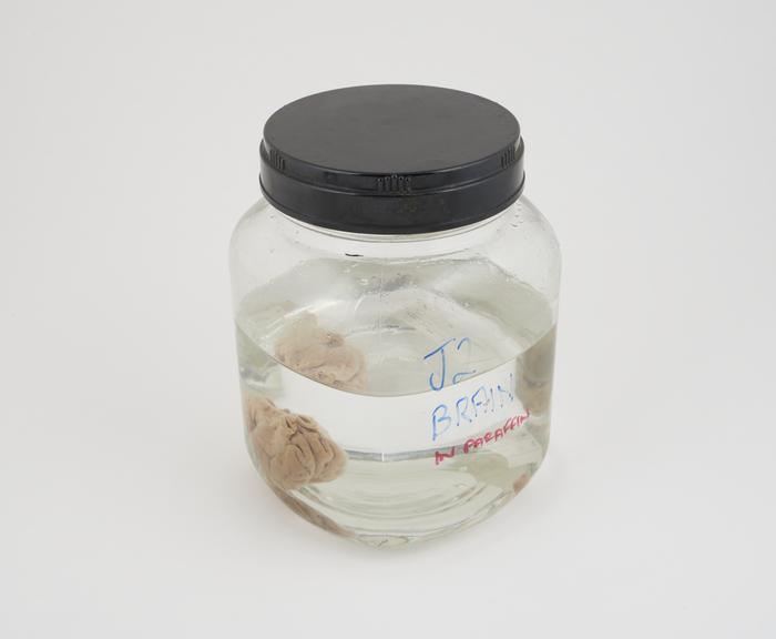 Pig brain in liquid paraffin, in large jar, dated 29.06