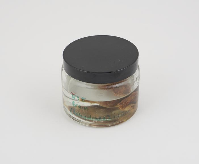 Pig brain in liquid paraffin, in small jar, (no date)