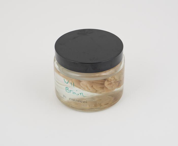 Pig brain in liquid paraffin, in small jar, dated 5.06