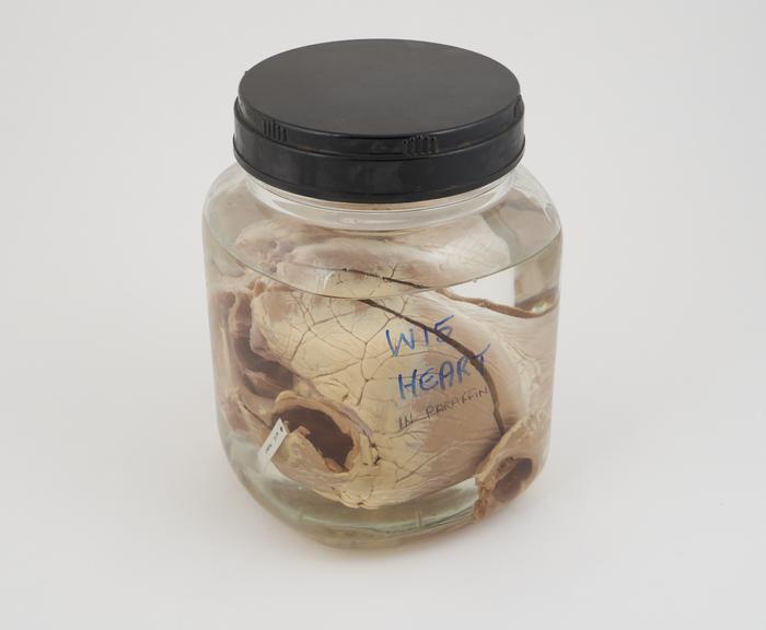 Pig heart in liquid paraffin, in large jar, labelled W15