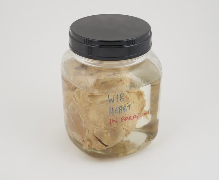 Pig heart in liquid paraffin, in large jar, labelled W18