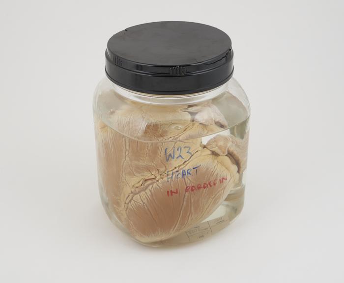 Pig heart in liquid paraffin, in large jar, dated 23.10