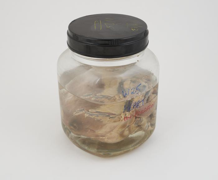 Pig heart in liquid paraffin, in large jar, dated 11.09