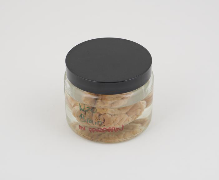 Pig brain in liquid paraffin, in small jar, dated 17.4