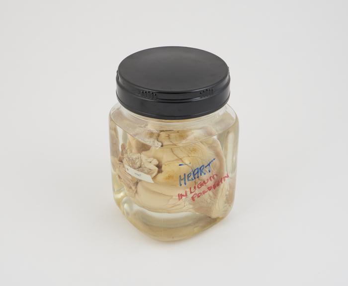 Pig heart in liquid paraffin, in jar (unlabelled)