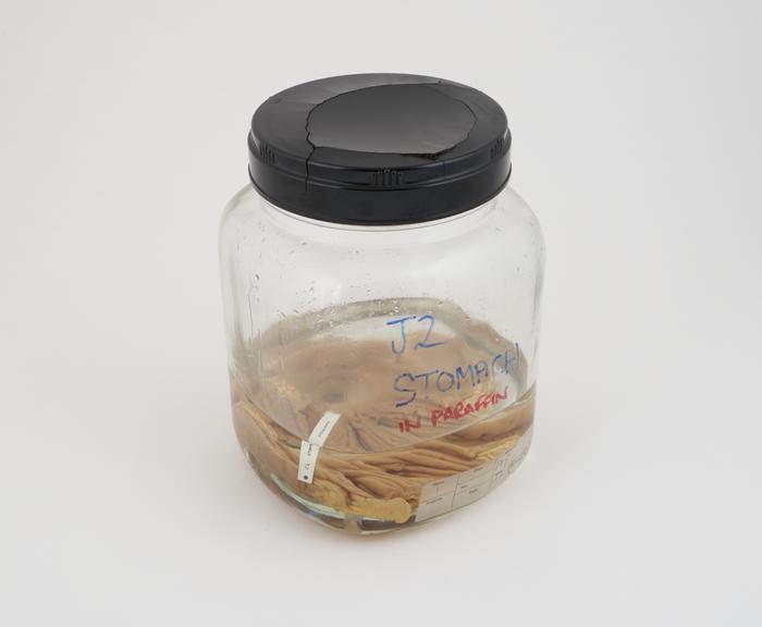 Pig stomach in liquid paraffin, in large jar, dated 29.06