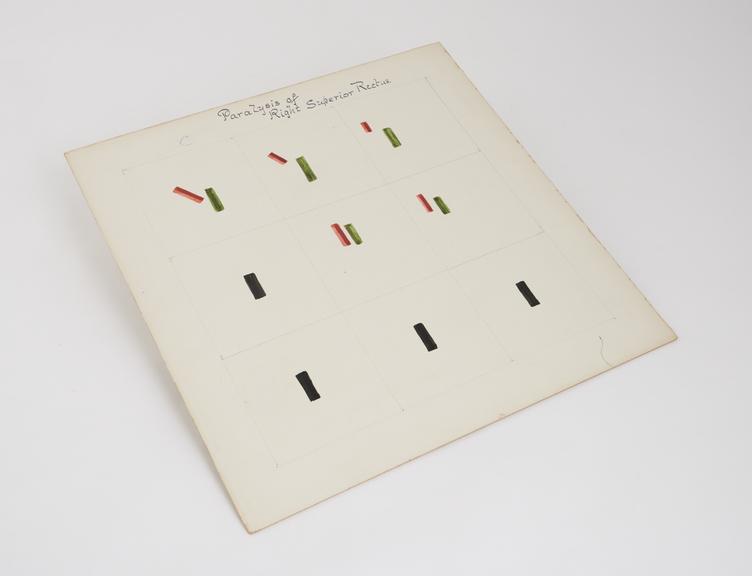 Square cardboard chart demonstrating light test in case of