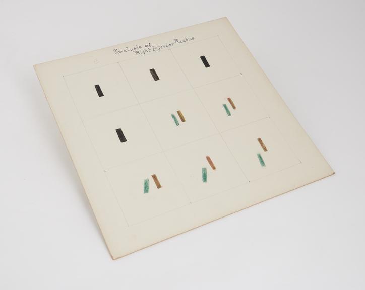 Square cardboard chart demonstrating light test for astigmatism