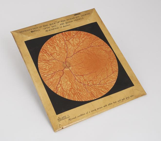 Plastic covered diagram of back of eye showing retina