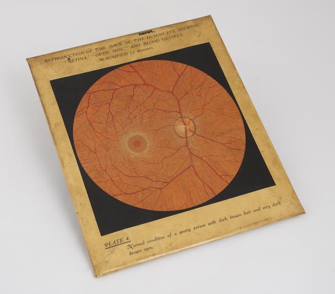 Plastic coated diagram illustrating back of eye showing retina