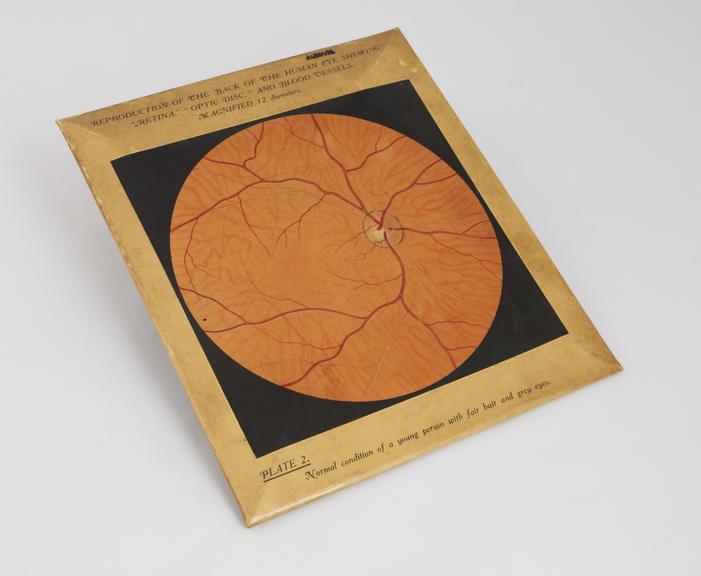 Plastic covered diagram of back of eye showing retina