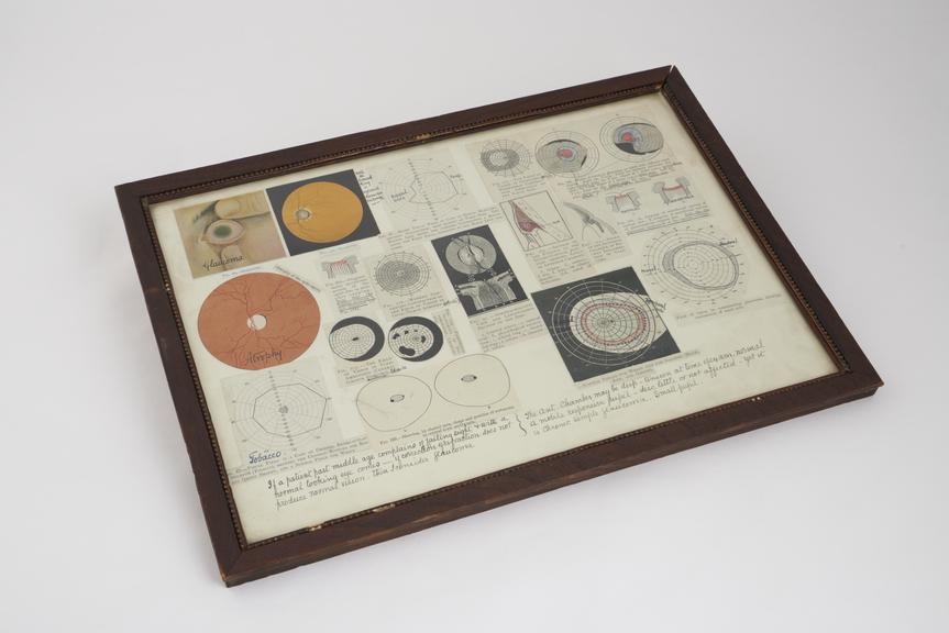 Diagram and notes describing glaucoma, glazed and framed by E