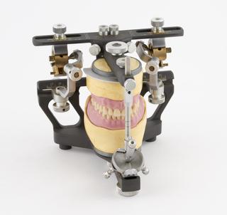 Set of dentures in dental articulator, England, 1981