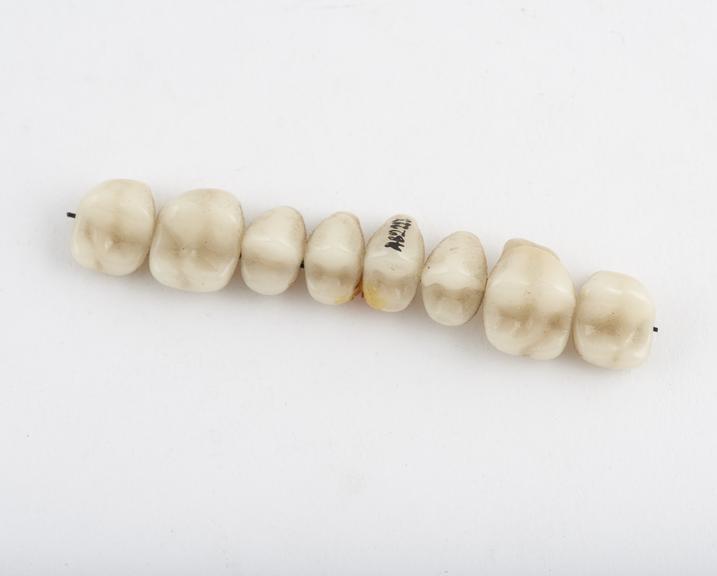 Set of false teeth, diatoric posteriors, porcelain, English