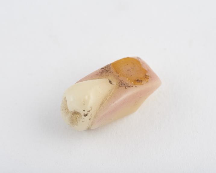 False tooth, gum section bicuspid